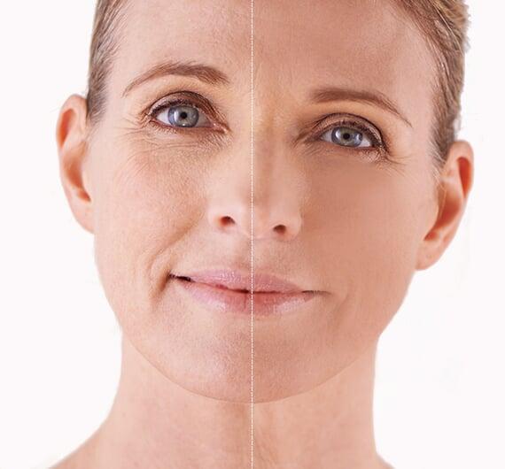 MedSpa Before After